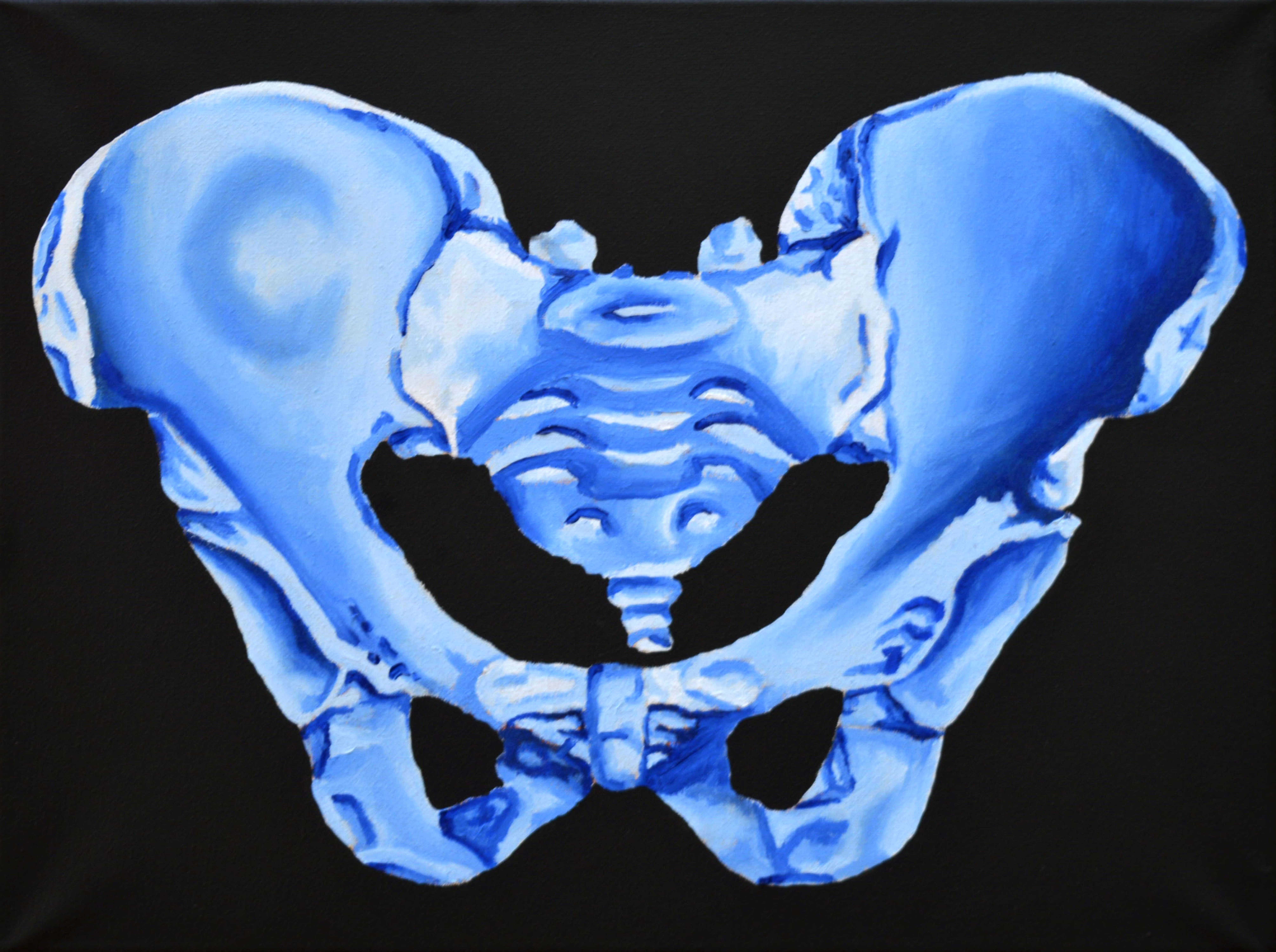 Pelvis 5 (blue)